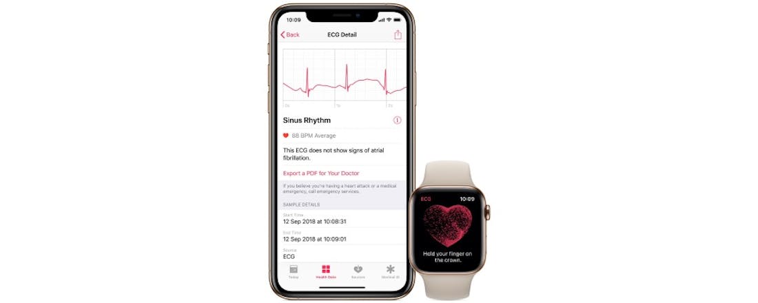 Apple Watch maakt hartfilmpje