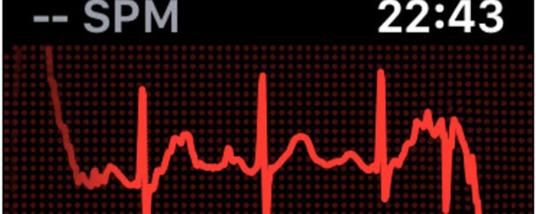 Hoe goed kan de Apple Watch 4 hartfilmpjes (ECG's) maken?